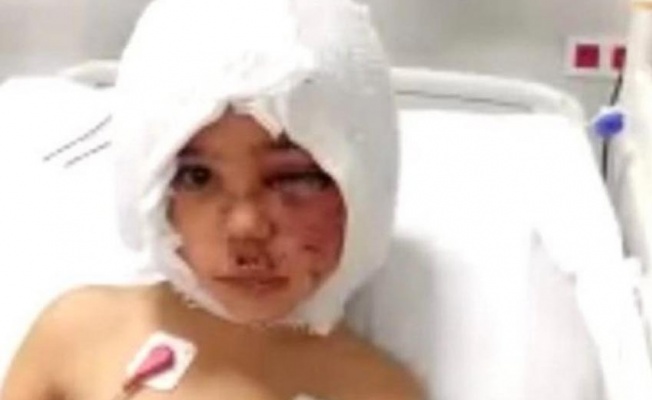 Pitbull saldırısında yaralanan Asiye Antalya'ya sevk edildi