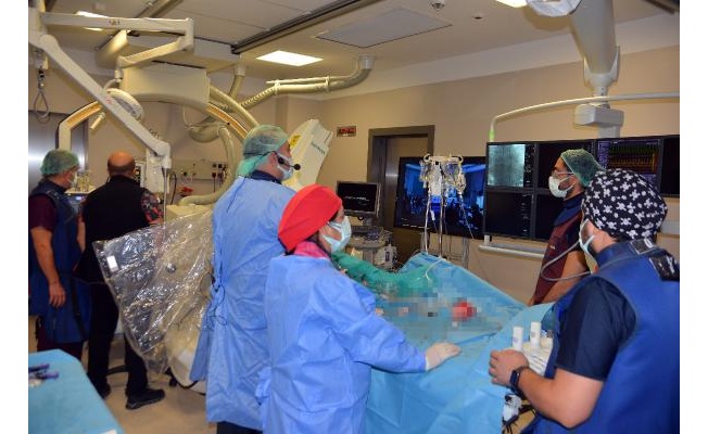 150 doktorun videokonferans ile izlediği kalp kapağı ameliyatı